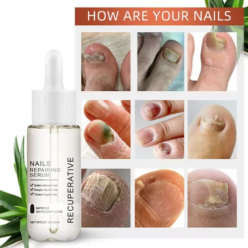 ENVÍO GRATIS 🎁 ⚡️ 7 días de crecimiento y fortalecimiento de uñas.