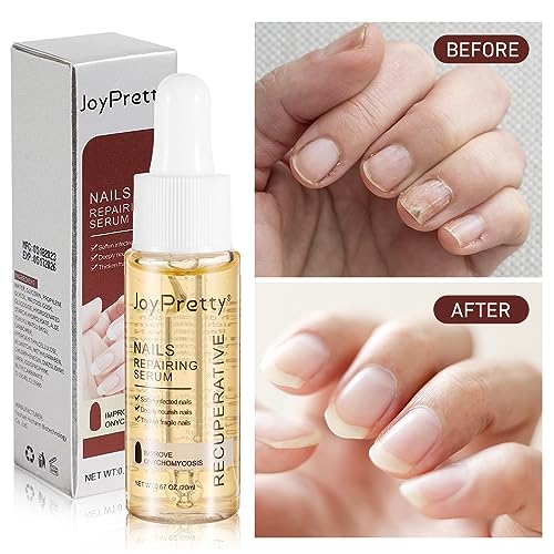 ENVÍO GRATIS 🎁 ⚡️ 7 días de crecimiento y fortalecimiento de uñas.